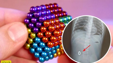 У Харкові через небезпечну іграшку немовляті провели складну операцію (фото)