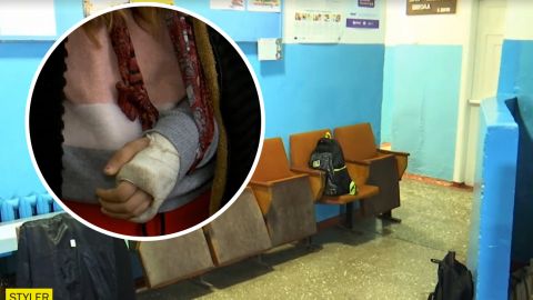 У школі під Одесою учениці на зламану руку поклали рибу і відправили додому: деталі скандалу