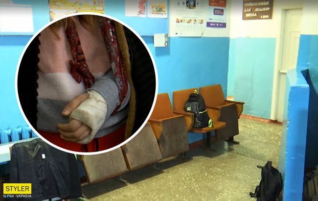 У школі під Одесою учениці на зламану руку поклали рибу і відправили додому: деталі скандалу