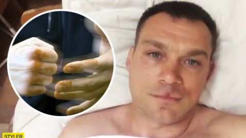 Избили в мэрии: под Киевом секретарь горсовета напал на переселенца (видео)