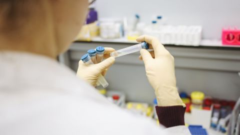 В Греции сообщили о первой смерти от коронавируса