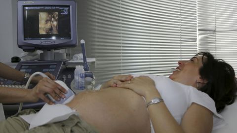 Аутизм у ребенка теперь можно определить на УЗИ во время беременности: что говорят медики