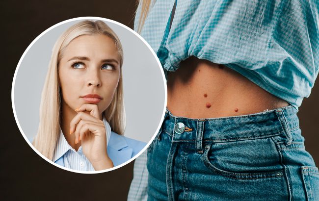 Эти приметы о родинках вы точно раньше не знали: что делать категорически нельзя