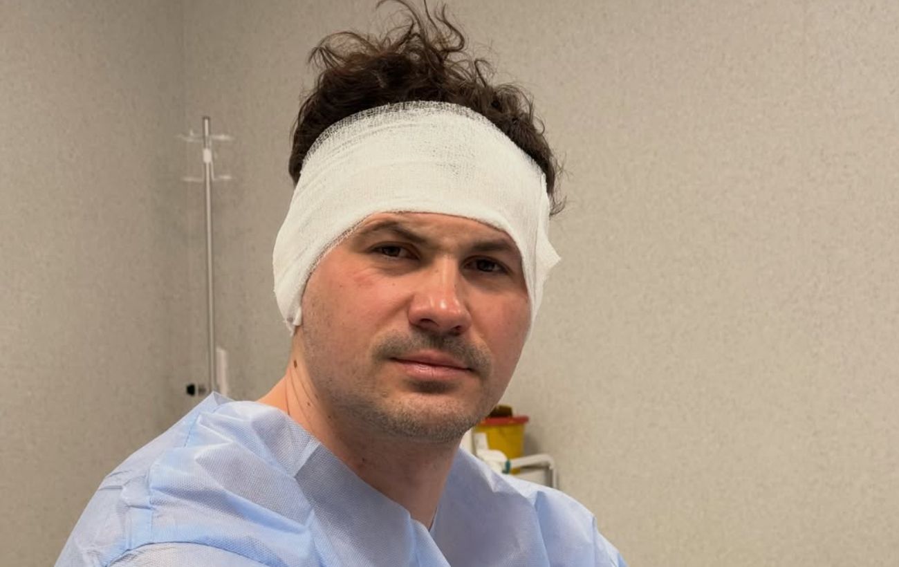 Женя Кот переніс операцію і налякав фанів фото з перев’язаною головою