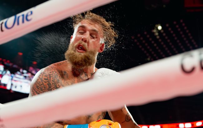 Джейк Пол несмотря на ужасные травмы бросил вызов другому экс-чемпиону мира: фото из больничной палаты