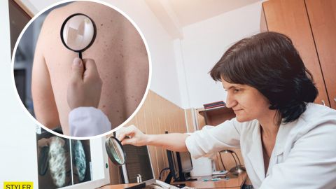 Врачи назвали симптомы рака, на которые часто не обращают внимания