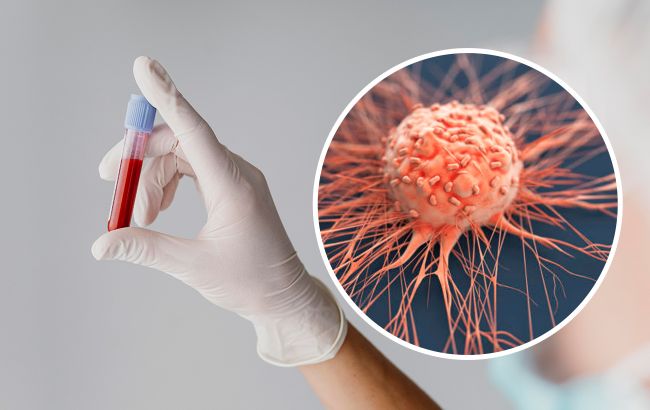 Названо групу крові, найменше схильну до раку