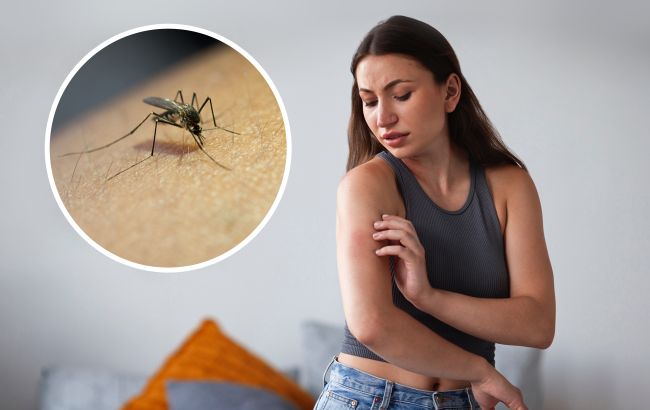 Не "крихітна" небезпека: укус цих комах може призвести до серйозної алергії