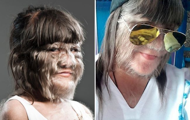 От "девочки-волчицы" до уверенной женщины: история необычной рекордсменки книги Гиннеса