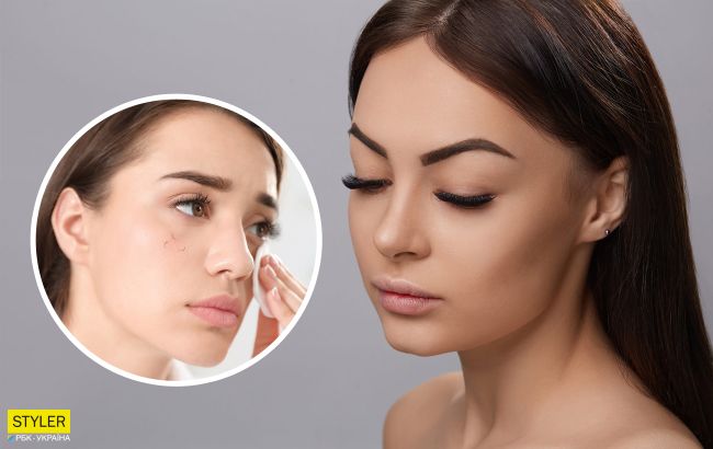 Почему у женщин выпадают ресницы: названы причины