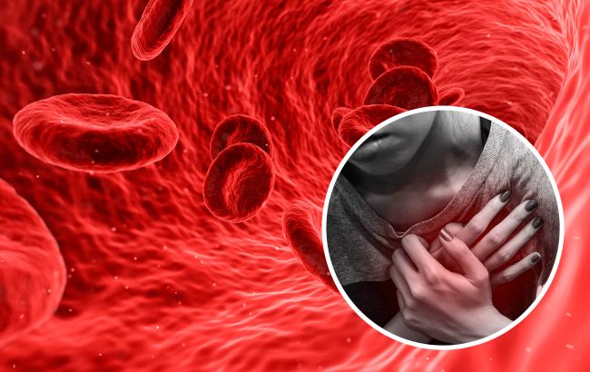 Отказ от курения и посещение врача. Украинцам рассказали, как снизить риск болезней сердца