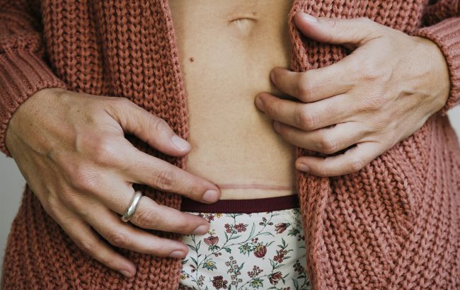 Шрами можуть стати менш помітними? Вчені випробовують революційний крем