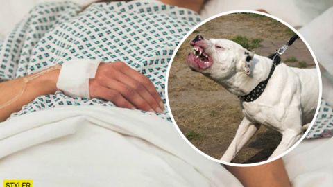 Перепрыгнул забор: под Киевом бойцовский пес набросился на пенсионерку (фото)