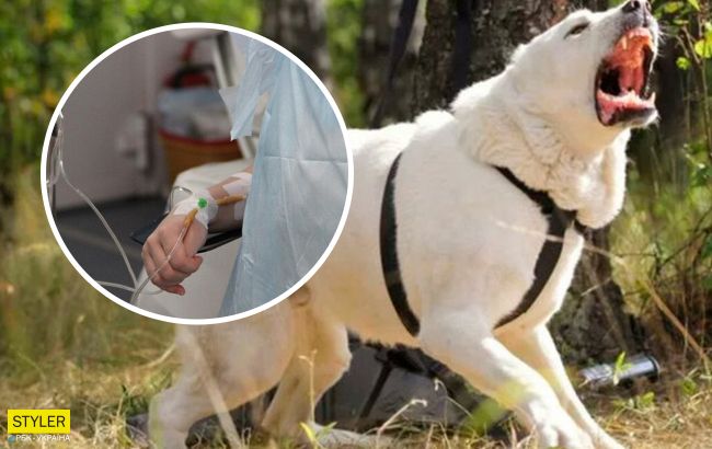 У Херсоні на дитину напав домашній алабай: дівчинка втратила багато крові