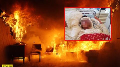 Дівчина, яку підпалив п'яний чоловік, прийшла до тями і раптово померла