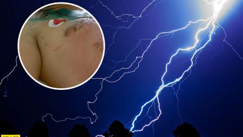 Шах і мат, атеїсти: хрестик врятував чоловіка від смерті при ударі блискавки (фото)