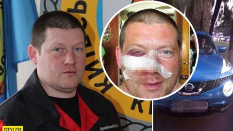 Автохамы по-звірячому побили рятувальника: деталі інциденту в Києві (фото)