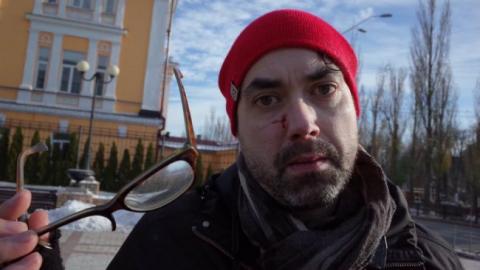 У МЗС засудили напад на канадського журналіста у Києві