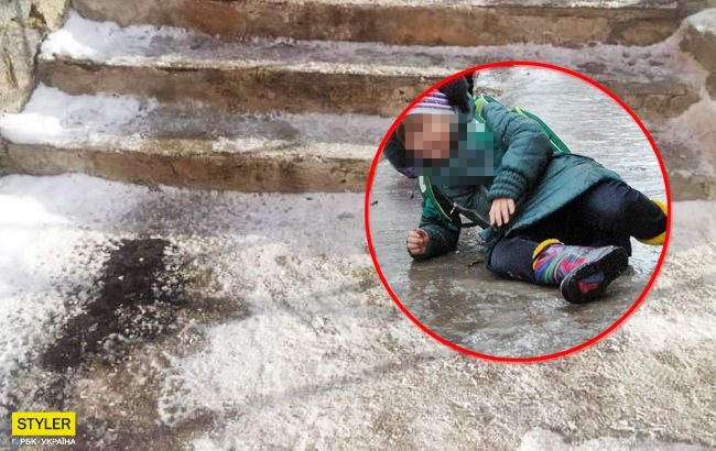 У бердичівській школі травмувалася п’ятикласниця: хто у цьому винен (фото)