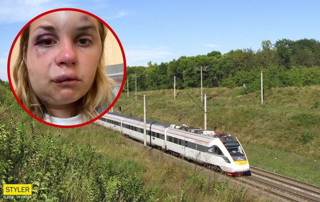 Избитой в поезде украинке стало хуже: новые фото из больницы