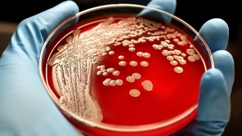 Под Одессой обнаружена сибирская язва: какие симптомы у больного