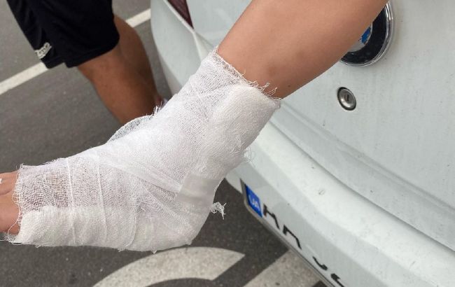 В киевском ТРЦ на ребенка упала витрина: у мальчика порезы на теле и перелом ноги