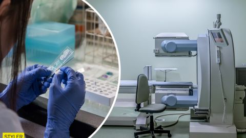 Вчені винайшли аналіз, який може виявити рак за чотири роки до його появи