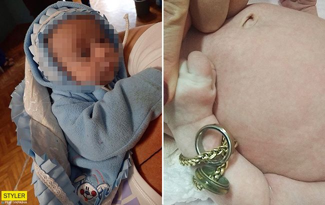 Младенец с кольцами: под Днепром обнаружили необычного новорожденного