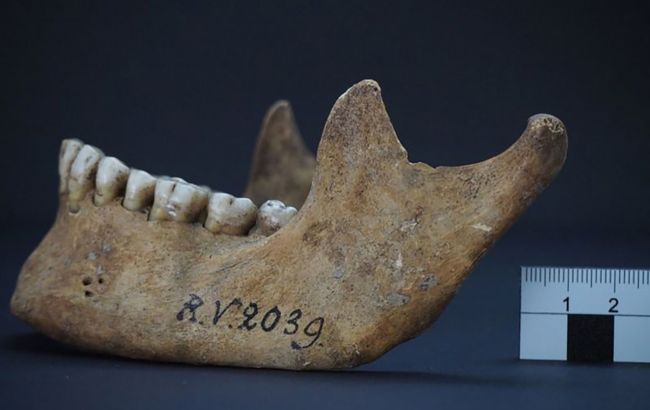 В Латвії знайшли "нульового пацієнта" найдавнішого штама чуми