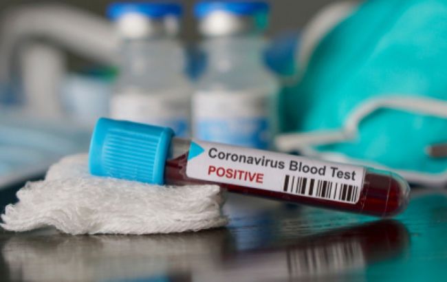 У Білорусі другий випадок зараження коронавірусом