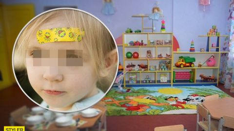Просто заклеїли пластиром: вихователі приховали серйозну травму дитини від батьків