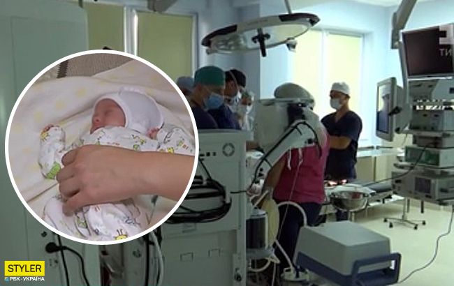 Пухлина-монстр: у Львові провели унікальну операцію новонародженій дівчинці