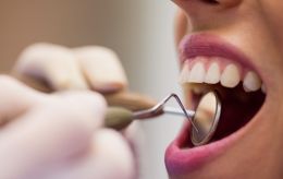 Стоматолог назвав 5 найгірших продуктів для ваших зубів