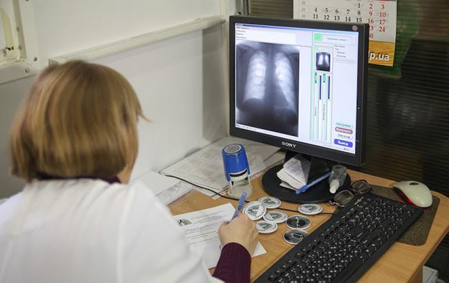 В Киеве можно пройти бесплатное обследование на передвижном флюорографе