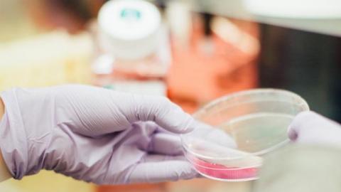 Епідемія алопеції: експерти розповіли, чому в Чернівцях полисіло понад 150 дітей