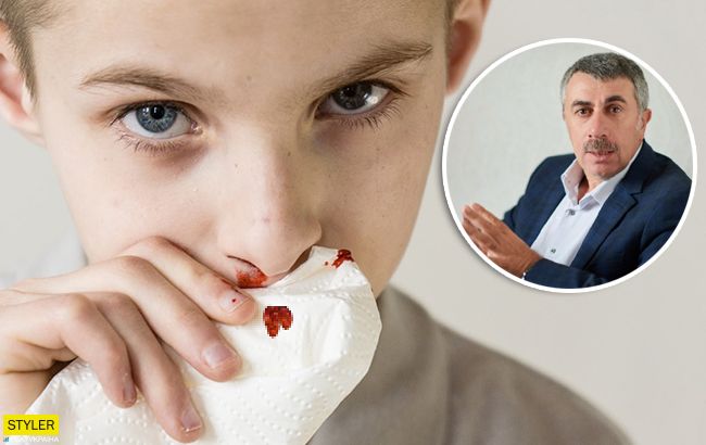 Комаровский рассказал, как оказать первую помощь при носовых кровотечениях