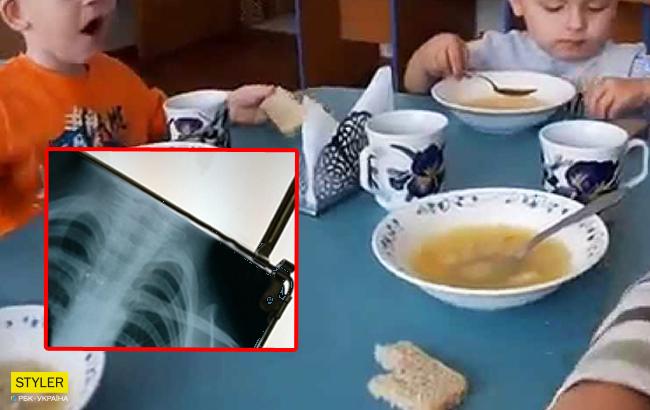 Нашел в супе проволоку: в киевском детсаду скандал