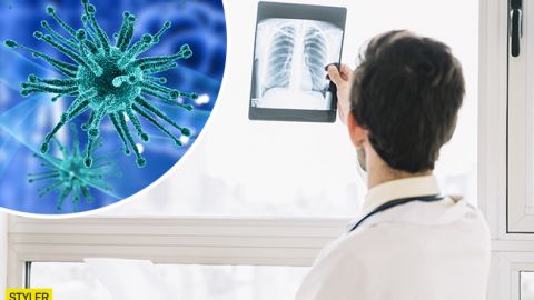 Коронавирус прячется от рентгена: медики нашли объяснение