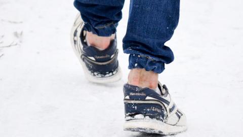 Хипстерам на заметку: Супрун предупредила об опасности оголенных щиколоток