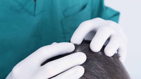 В Україні почалася епідемія педикульозу: як впоратися з навалою комах