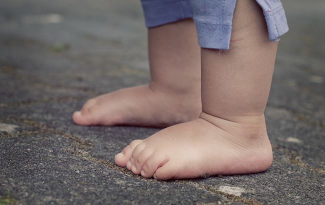Ноги відмовили через застуду: в Одесі лікар ледве не погубила маленьку дитину