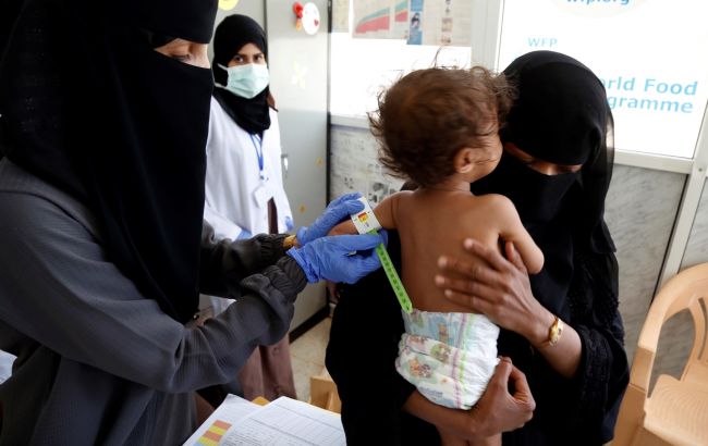 ООН попереджає про "катастрофічне" недоїдання дітей війни Росії проти України