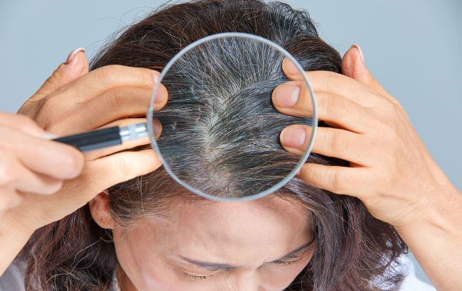 Чи можна зупинити раннє посивіння волосся: пояснення трихолога