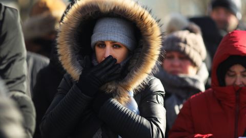 Бережіть волосся і голову: лікар розповіла, при якій погоді потрібно надягати шапку