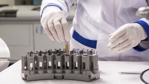 Викинуті гроші: лікарі назвали топ-10 непотрібних аналізів