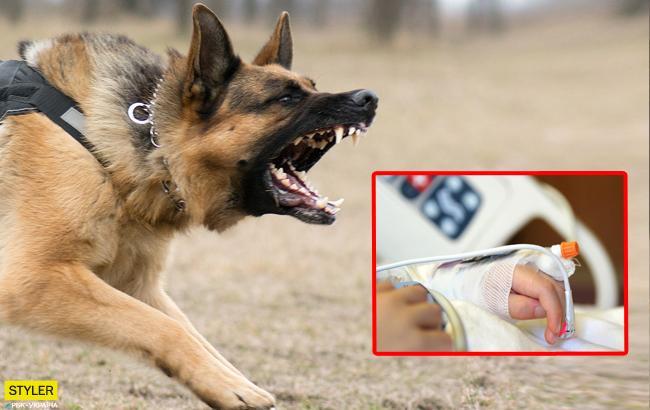 Врачи рассказали о состоянии покусанной собаками девочки в Запорожской области