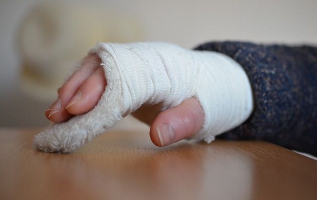 Девушка получила жуткие травмы: в Киеве ищут свидетелей ДТП