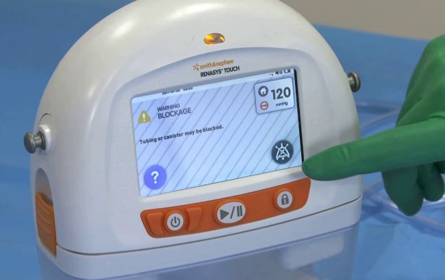 Фонд Ахметова і ДТЕК передали в "Охматдит" апарати для загоєння важких ран