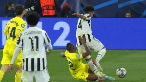 Игрок "Ювентуса" получил серьезную травму в матче Лиги чемпионов