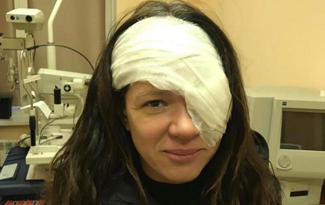 Руслана перенесла серьезную операцию на лице